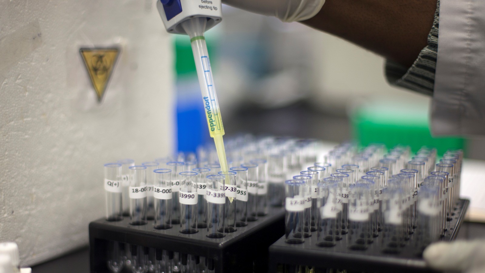 ظهور الدم في البول.. ماذا يعني وكيف نعالجه؟ 2 ظهور الدم في البول.. ماذا يعني وكيف نعالجه؟