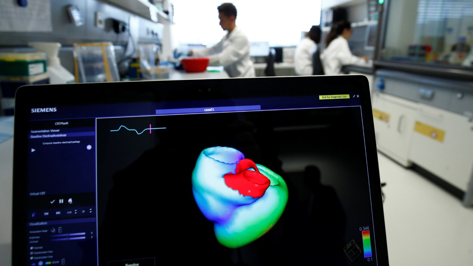 علاج جيني جديد لفشل القلب يحقق "نتائج مبهرة" خلال التجارب 2 علاج جيني جديد لفشل القلب يحقق "نتائج مبهرة" خلال التجارب