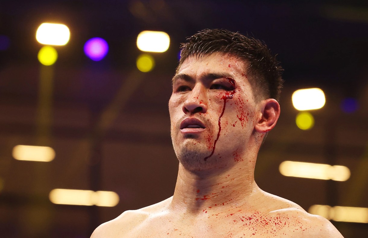 مستوحاة من Dmitry Bivol Avenges خسارة Artur Beterbiev في فيلم Triller بلا منازع 8 تم قطع Bivol بشكل سيء ، لكنه وضع علامة Beterbiev في جميع أنحاء المباراة