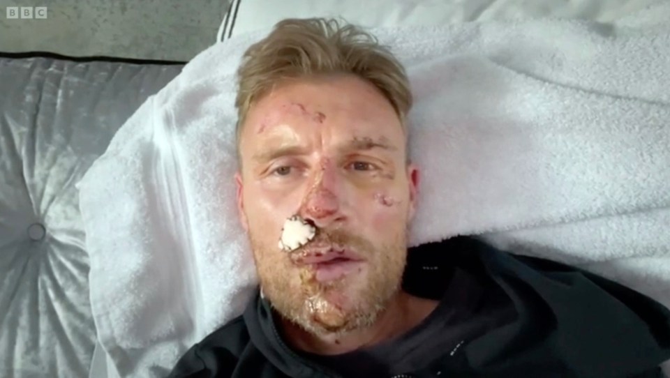 يترك فريدي فلينتوف الابن روكي ، 17 عامًا ، من فريق إنجلترا ليونز لاختبار الهند فريدي فلينتوف مع إصابات الوجه.