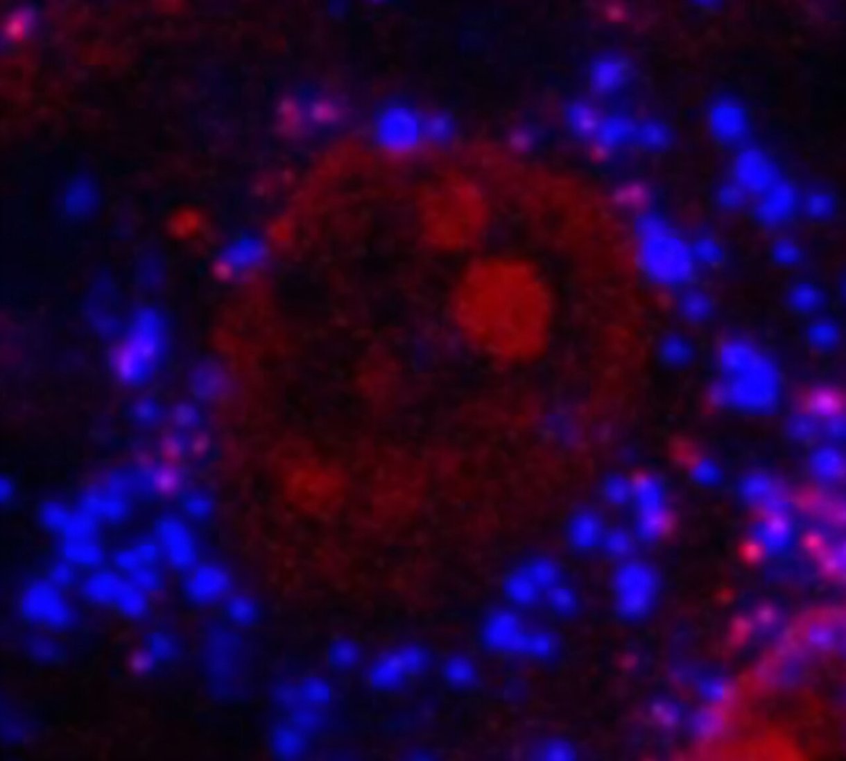 تم العثور على البلاستيكات الدقيقة العميقة داخل العظام البشرية ، يحذر العلماء: Sciencealert 2 أبرز الأزرق من البلاستيك الدقيق في خلية عظمية